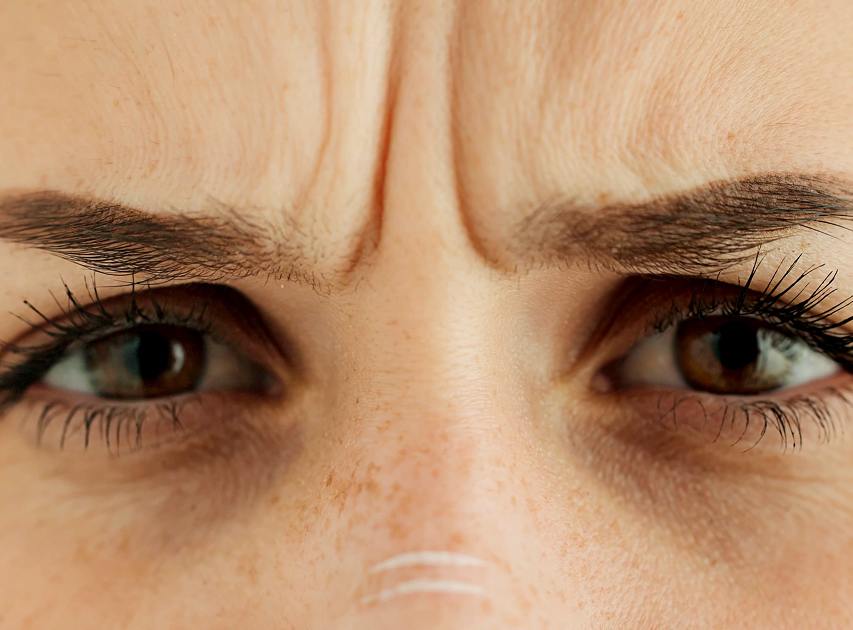 Areas Treated with Anti-wrinkle Treatment | Dr. Haror's Wellness Areas Treated with Anti-wrinkle Treatment | Dr. Haror's Wellness