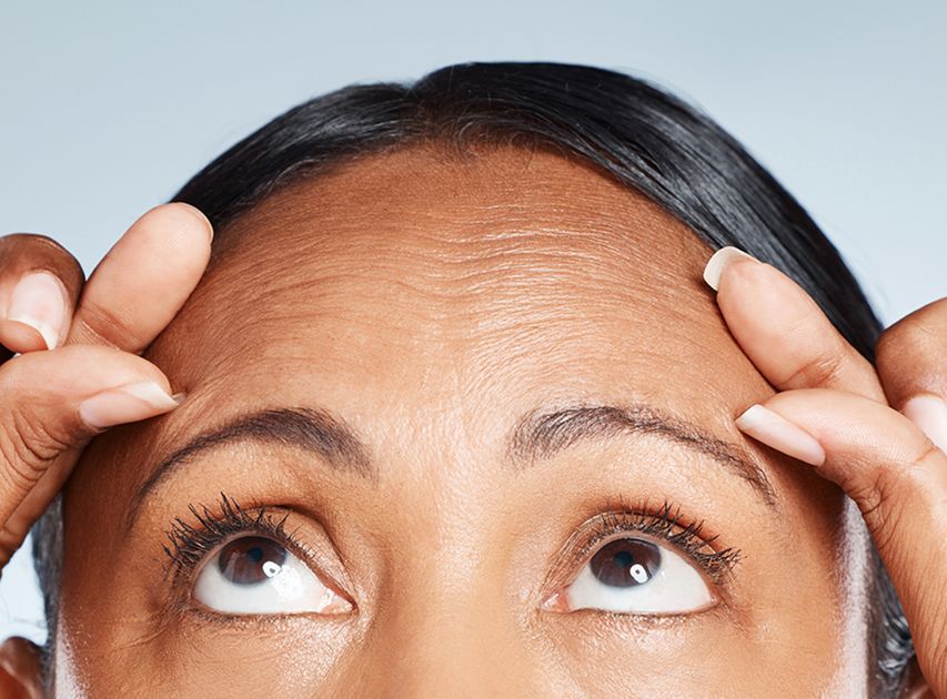 Candidates for Botox Treatment | Dr. Haror's Wellness Candidates for Botox Treatment | Dr. Haror's Wellness