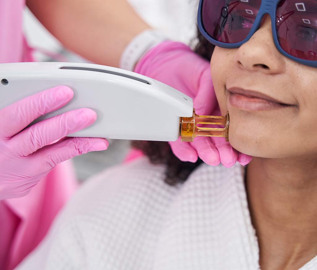 Common Myths About Fractional CO2 Lasers | Dr. Haror's Wellness Common Myths About Fractional CO2 Lasers | Dr. Haror's Wellness