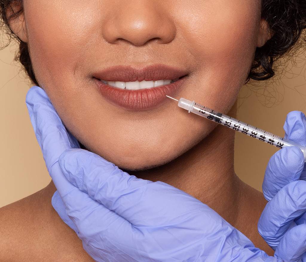 Common Myths About Lip Fillers | Dr. Haror's Wellness Common Myths About Lip Fillers | Dr. Haror's Wellness