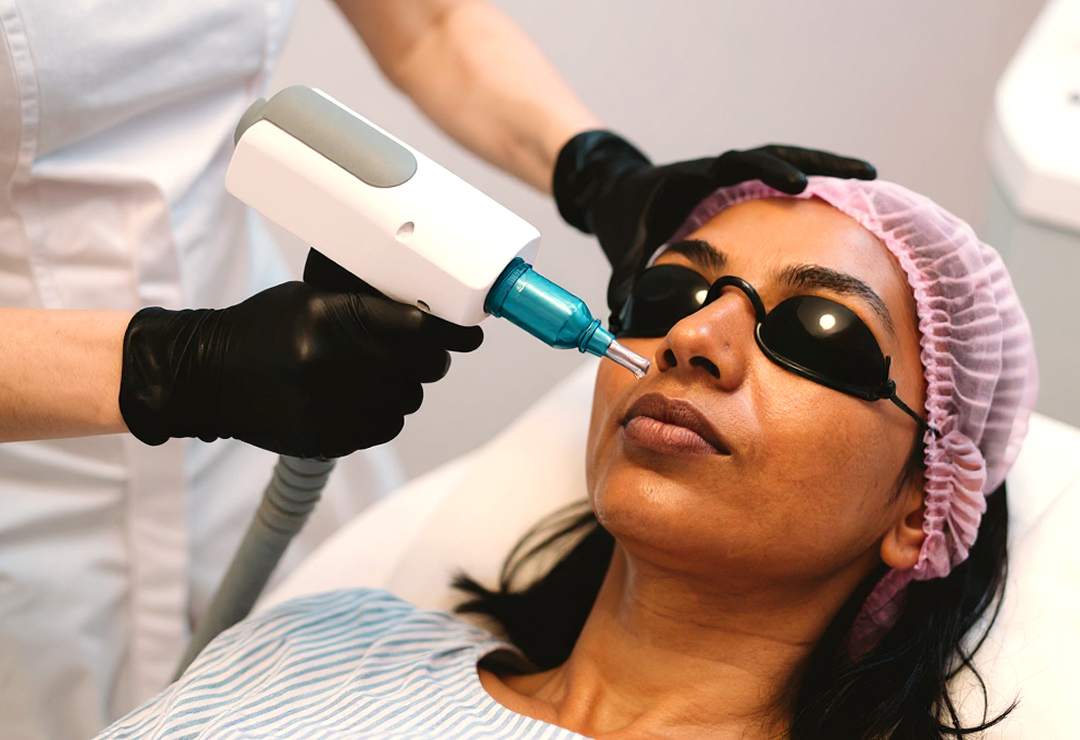 Fractional CO2 Lasers banner | Dr. Haror's Wellness Fractional CO2 Lasers banner | Dr. Haror's Wellness