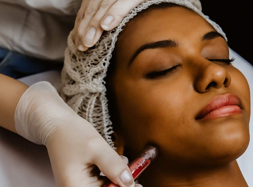 What to Expect During Fractional CO2 Lasers | Dr. Haror's Wellness What to Expect During Fractional CO2 Lasers | Dr. Haror's Wellness